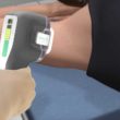 Hyperhidrosis Treatments