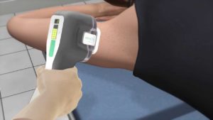 Hyperhidrosis Treatments