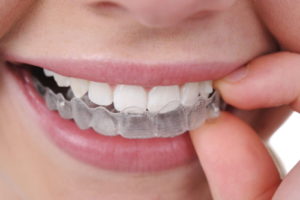 What Are Cosmetic Dental Surgery Costs