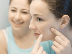 Laser Skin Treatment for Acne Removal