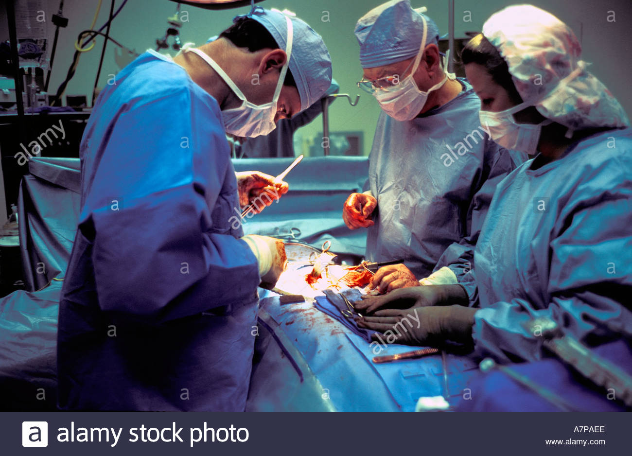 surgical team performs kidney transplant in operating room A7PAEE