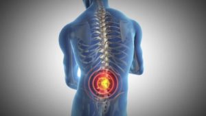 Good Chiropractic Care and Back Pain