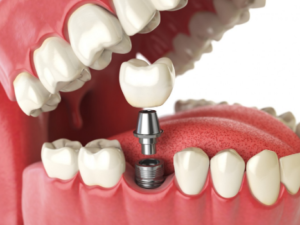 teeth